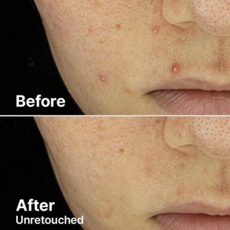 Serum exfoliant cu AHA 2% si BHA 2%, 50 g, Cosrx 659681